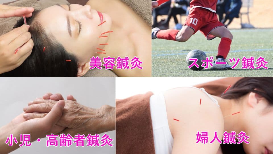 日本医専(旧校名:日本医学柔整鍼灸専門学校) 【スポーツ・美容・婦人・高齢者 ~4大鍼灸を知ろう~】